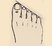  Độ dài ngón chân tiết lộ gì về tương lai của bạn?