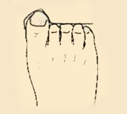  Độ dài ngón chân tiết lộ gì về tương lai của bạn?